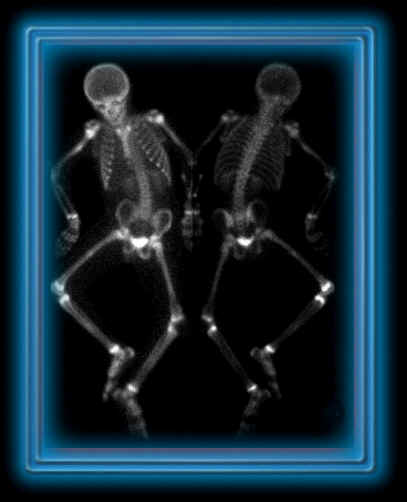 Illustration of skeletons dancing